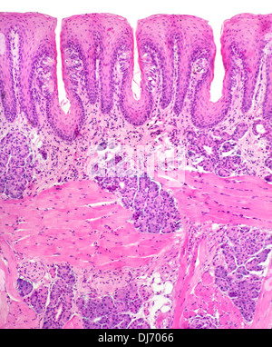 Papillae taste buds, human tongue, bright field photomicrograph ...