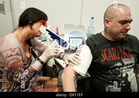 Warsaw, Poland. 1st December 2013. Woman removes tattoo from her client's arm using laser equipment during the second day of tattoo, body painting and pierceing show - 1st Warsaw Tattoo Convention 2013 in Pepsi Arena in Warsaw, Poland Credit:  kpzfoto/Alamy Live News Stock Photo