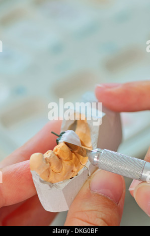 hand of dental technician working on ceramic inlays in a lab Stock Photo