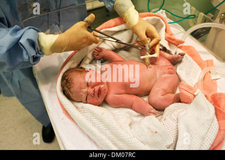 Baby Just Born With Midwife Cutting The Umbilical Cord Stock Photo - Alamy