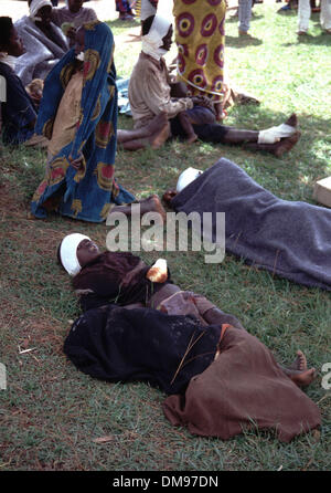 Apr 08, 1994 - Burundi, Rwanda - victims have bandages to the head, back of neck and children to the hands where they have been struck by machetes. The children had their fingers cut off. The Rwandan Genocide was the 1994 mass murder of an estimated 800,000 people in the small East African nation of Rwanda. Over the course of approximately 100 days from the assassination of Habyari Stock Photo