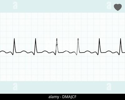 Normal electrocardiogram ECG. EPS 8 Stock Vector