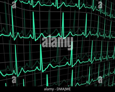 Pulse rate Line on green chart background of monitor. Illustration ...