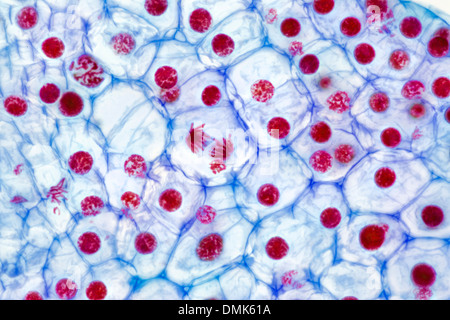 Brightfield Photomicrograph. Lily Ovary Cells Showing Chromosome 