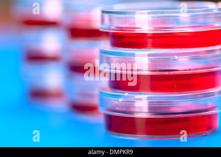 Plastic petri dish with red liquid, the study of cholesterol in the blood Stock Photo