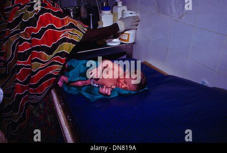 Nov. 30, 1993 - Kismayo, Somalia - A newly born baby just five minutes old - umbilical cord still attached - on a table in Kismayo hospital Somalia. (Credit Image: © Theodore Liasi/ZUMAPRESS.com) Stock Photo