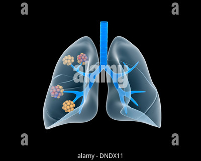 Conceptual image of human lungs. Stock Photo