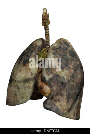 3D digital render of rotten lungs of smokers isolated on white ...