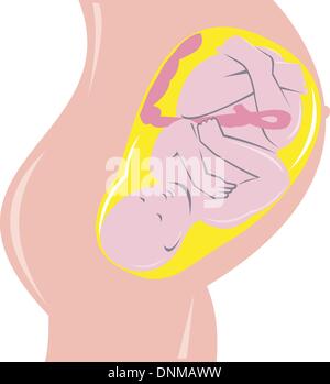 illustration on the development of the human fetus inside womb done in retro woodcut style. Stock Vector