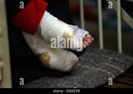 Dec 07, 2005; Islamabad, PAKISTAN; Aftermath of Pakistan Earthquake on October 8, 2005. The feet of a young girl who is recovering at the Pakistan Institute of Medical Sciences is comforted by her dad's arms in Islamabad, Pakistan. Mandatory Credit: Photo by Nelvin Cepeda/San Diego Union T/ZUMA Press. (©) Copyright 2005 by San Diego Union T Stock Photo