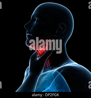 sore throat image clipart library