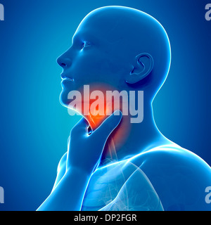 Sore throat, artwork Stock Photo