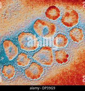TEM of a cluster of corona viruses Stock Photo