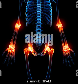 Joint pain, artwork Stock Photo