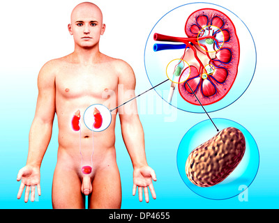 Human kidney stones, artwork Stock Photo