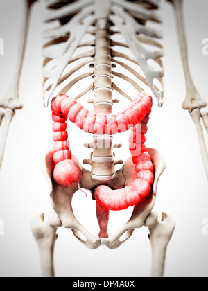 Inflamed colon, artwork Stock Photo