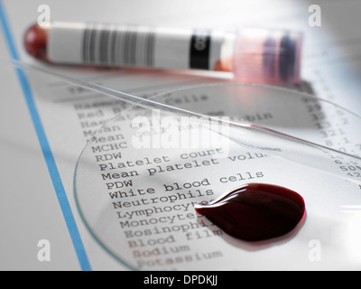 Blood sample with results of clinical analysis of the blood component Stock Photo