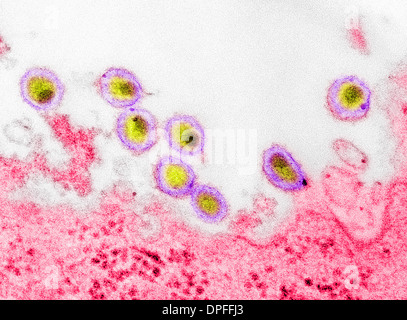 Transmission electron micrograph of AIDS, HIV-1 Stock Photo