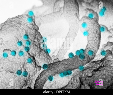 Scanning electron micrograph of HIV-1 virus Stock Photo