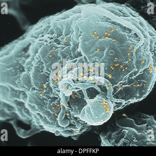 SEM of human immunodeficiency virus (HIV) Stock Photo