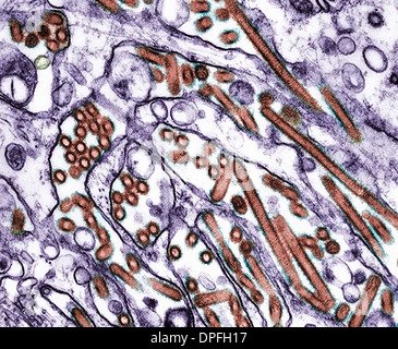 TEM ( of Avian influenza A H5N1 viruses Stock Photo