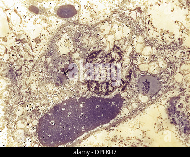 Liver tissue hepatocytes. Transmission electron micrograph (TEM) of a ...