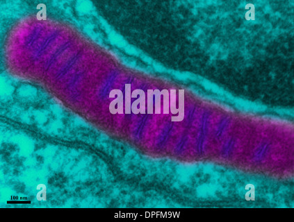 TEM of lung tissue Stock Photo
