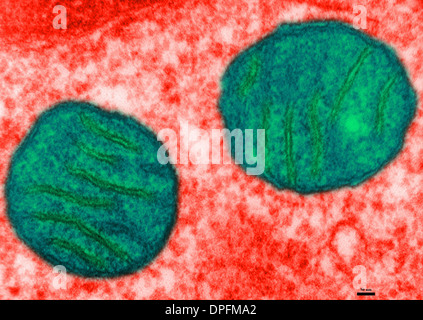 TEM of lung tissue Stock Photo