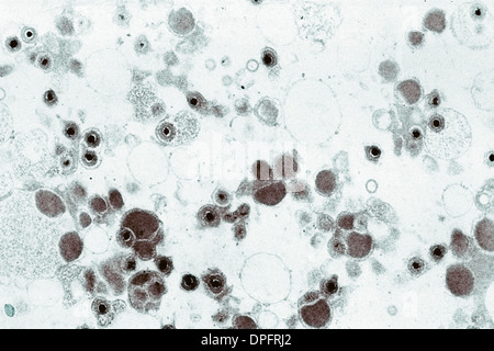 electron-microscope-image-of-cytomegalovirus-stock-photo-alamy