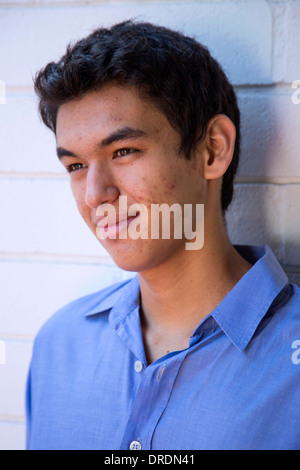 Male adolescent with acne on his face Stock Photo