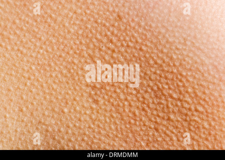 Goosebumps Skin Background Stock Photo