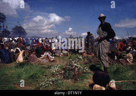 'RWANDAN CIVIL WAR', TUTSI MAN, CHOPPED ACROSS THE HEAD BY MACHETE, IS ...