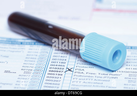 Color coded tube containing synthetic blood sample on a bloodwork requisition form that lists a test for prostate-specific Stock Photo