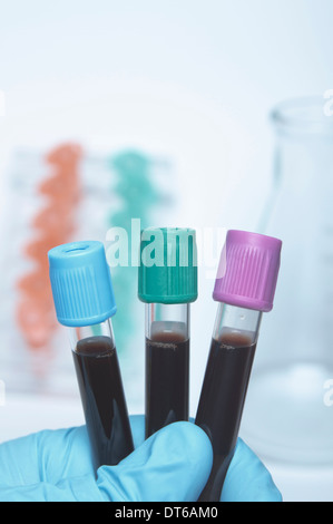 Color coded blood tubes containing synthetic blood samples. Blue top - buffered sodium citrate. Green top - lithium heparin Stock Photo
