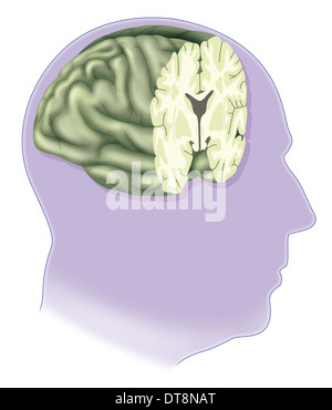 BRAIN DRAWING Stock Photo