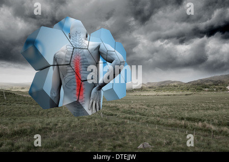 Composite image of back injury diagram on abstract screen Stock Photo