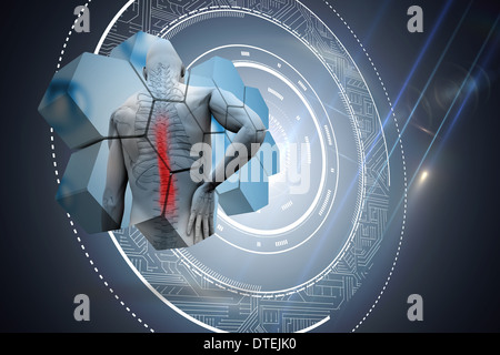 Composite image of back injury diagram on abstract screen Stock Photo