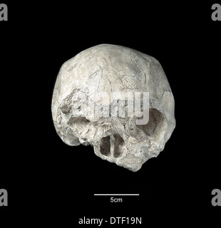 Homo sapiens skull