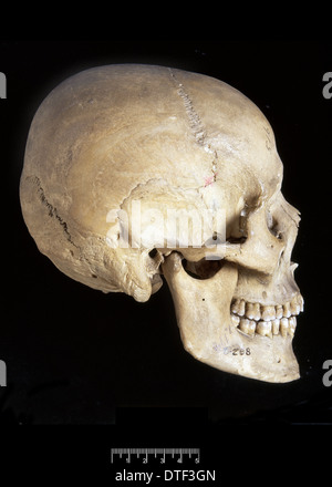 Homo sapiens skull (Italy)