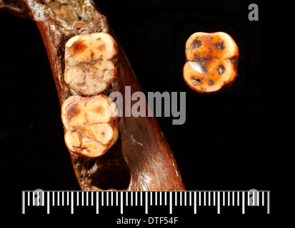 Piltdown 1 jaw with Piltdown 2 molar Stock Photo