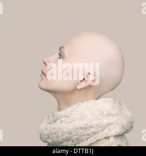 Caucasian woman with bald head Stock Photo