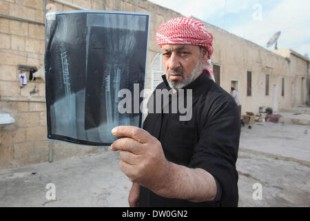 Feb. 21, 2014 - Al-Kitteh, Jarash, Jordan - Ahmad Mansour, 54, displays his hand X-rays at his house in the village of al-Kitteh western city of Jerash, 50 km northern the Jordanian capital Amman on February 21, 2014 . Mansour arrived on foot on a stretcher as a Syrian refugee to Jordan one year ago after he was wounded in his left hand and his back by a mortar shell landed on his house in Daraa, followed by his wife and his twelve children after three months (Credit Image: © Ahmad Abdo/APA Images/ZUMAPRESS.com) Stock Photo