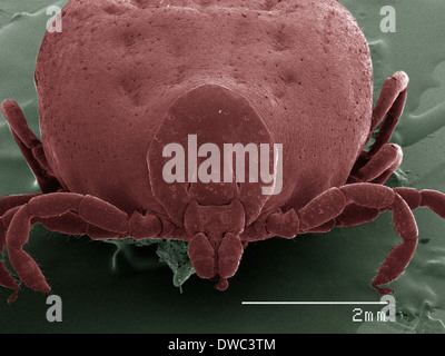 Tick Particles Tick. Coloured scanning electron micrograph (SEM). This is the ventral ...