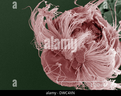 Coloured SEM of Stock Photo