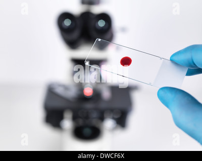 Laboratory scientist holding a slide containing a blood sample with a upright compound microscope in the background