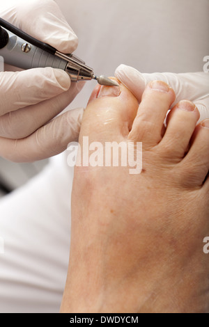 A chiropodist taking care of woman's foot - polishing nails with a special tool Stock Photo
