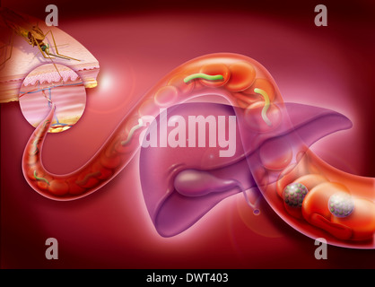 Malaria, illustration Stock Photo