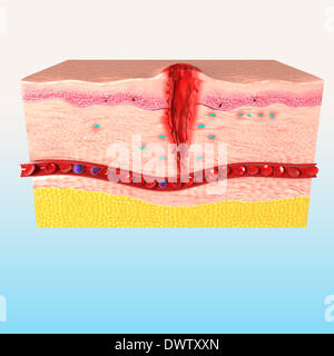 Healing Wound Drawing Stock Photo - Alamy