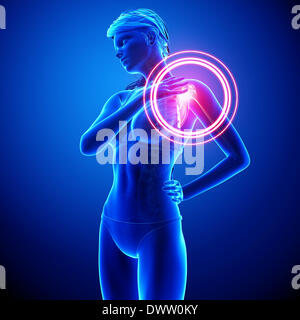 Shoulder pain woman drawing Stock Photo - Alamy