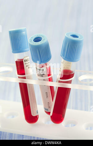 Blood specimen Stock Photo